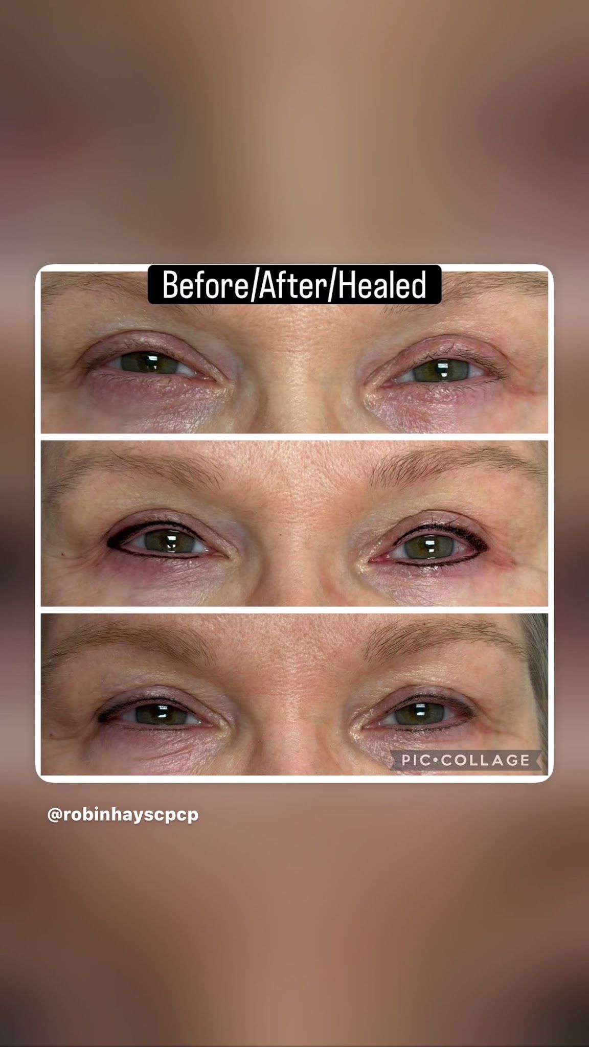 Lash Liner result by Robin Hays Permanent Makeup/ About Face Inc in Atlanta, GA