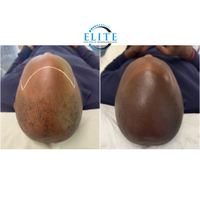 Elite Institute of Micropigmentation — permanent makeup work