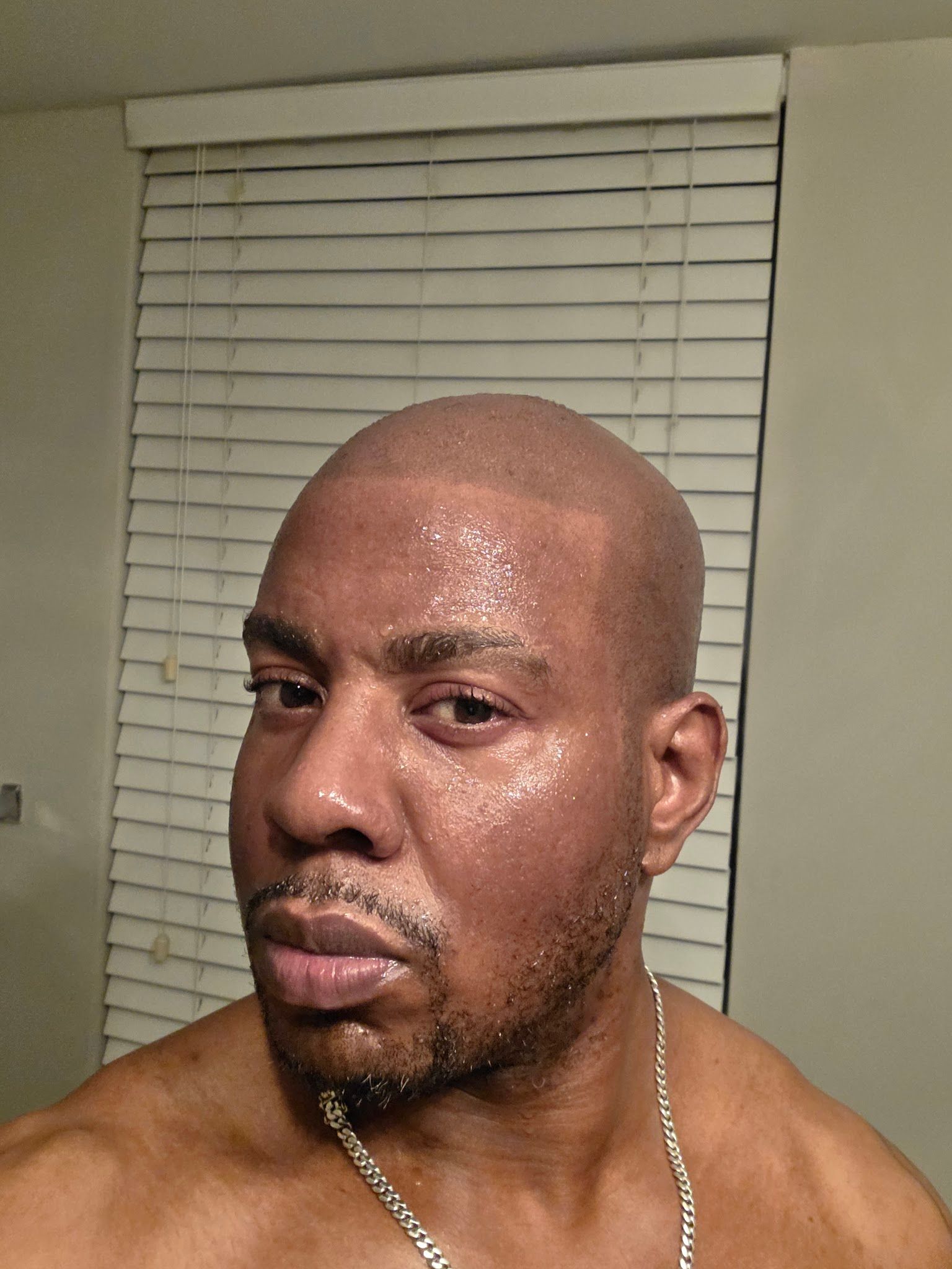 Scalp Micropigmentation result by Elite Institute of Micropigmentation Atlanta in Atlanta, GA