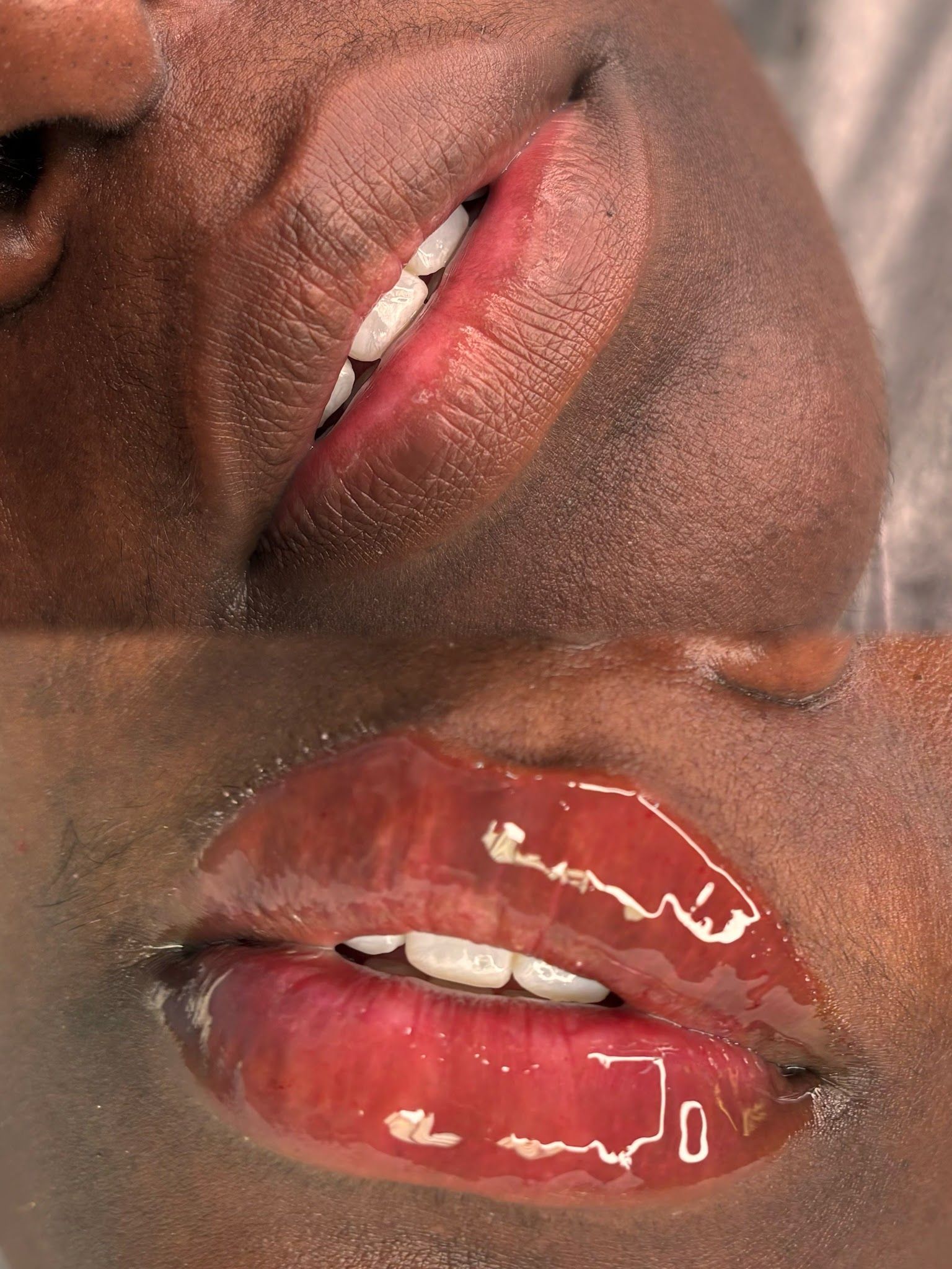 Lip Blush result by Karisma Beaute Effect in Atlanta, GA