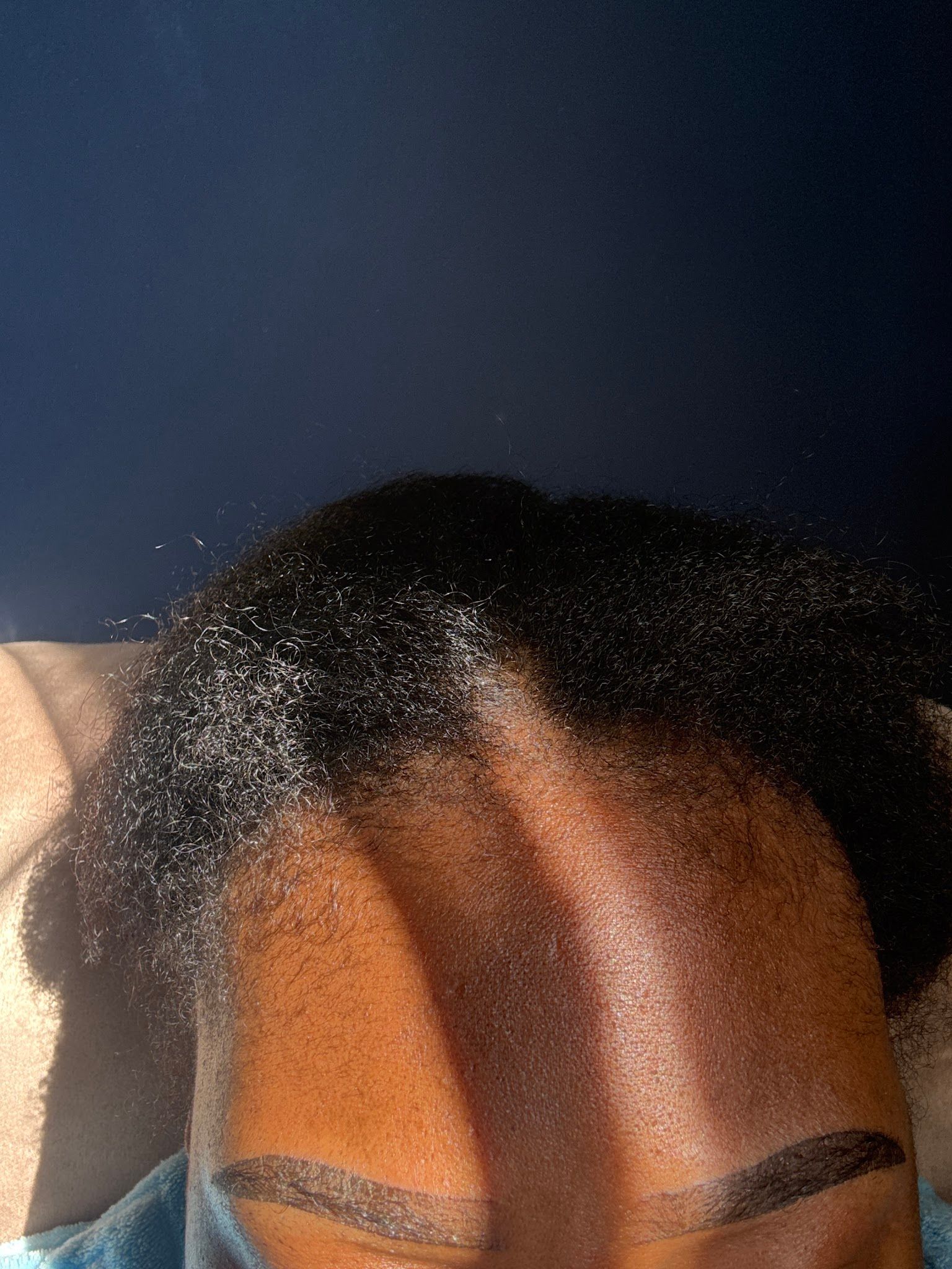 Scalp Micropigmentation result by Be Browed ATL in Snellville, GA