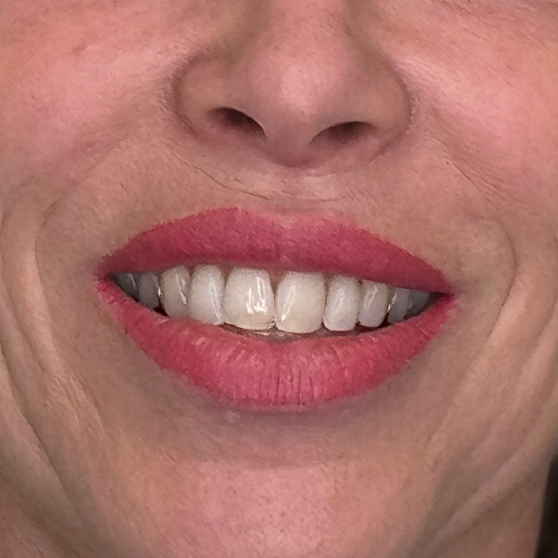 Lip Blush result by Look Natural Atlanta in Sandy Springs, GA