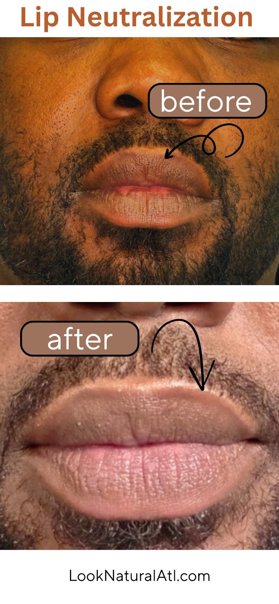 Lip Blush result by Look Natural Atlanta in Sandy Springs, GA